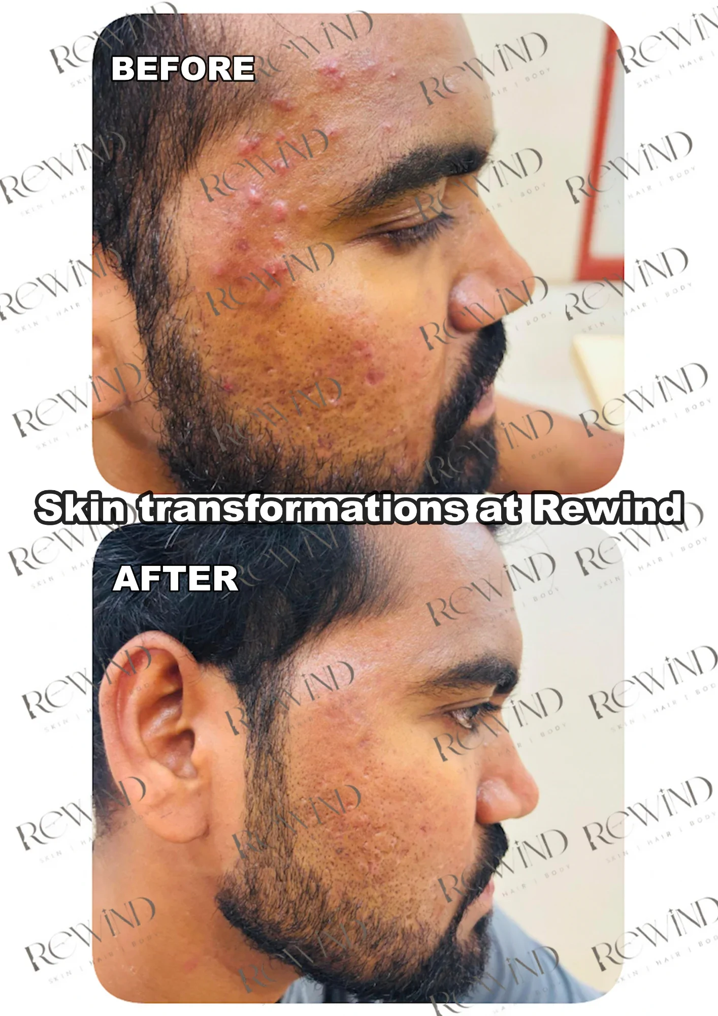 SKIN RESULTS