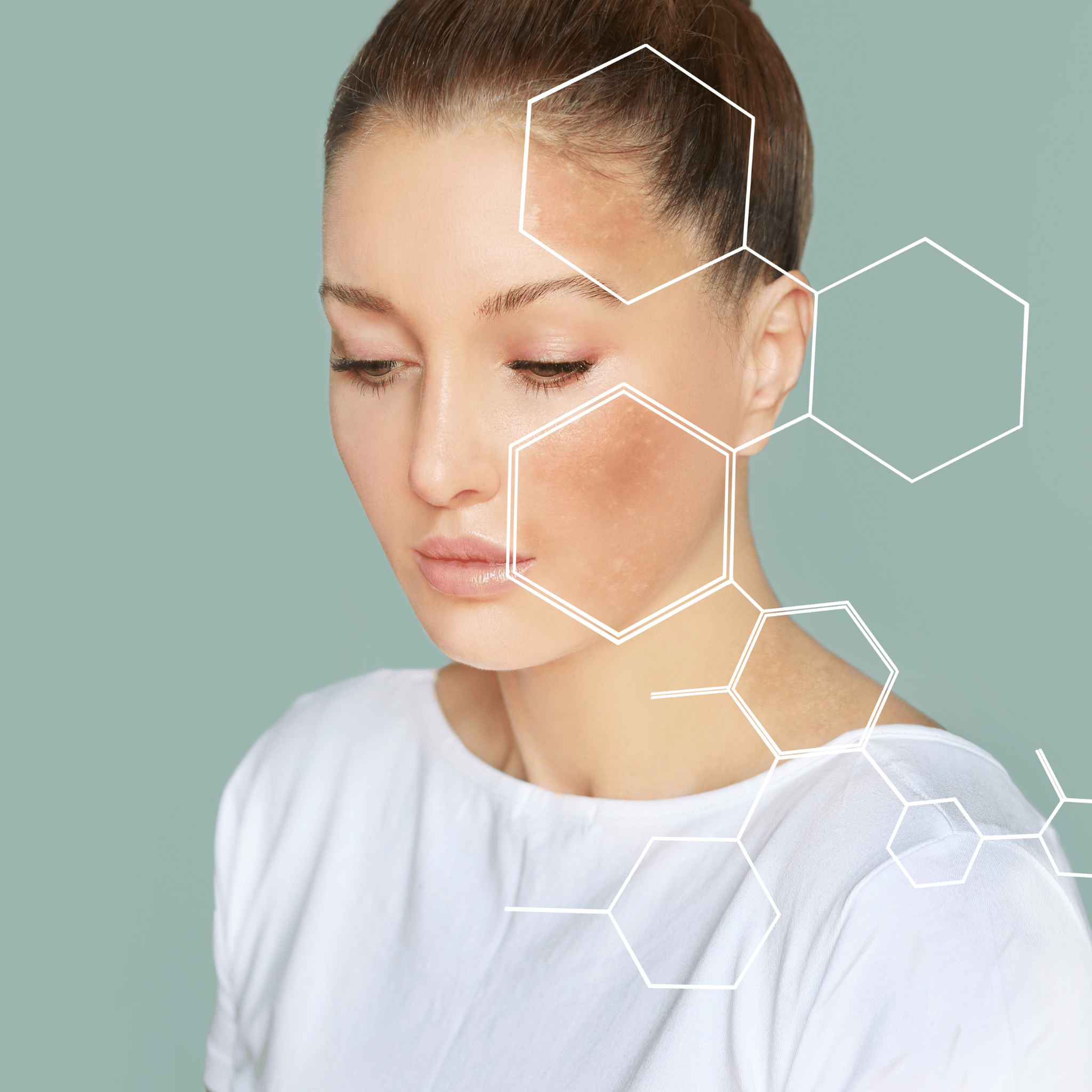 Pigmentation & Skin Brightening in vizag