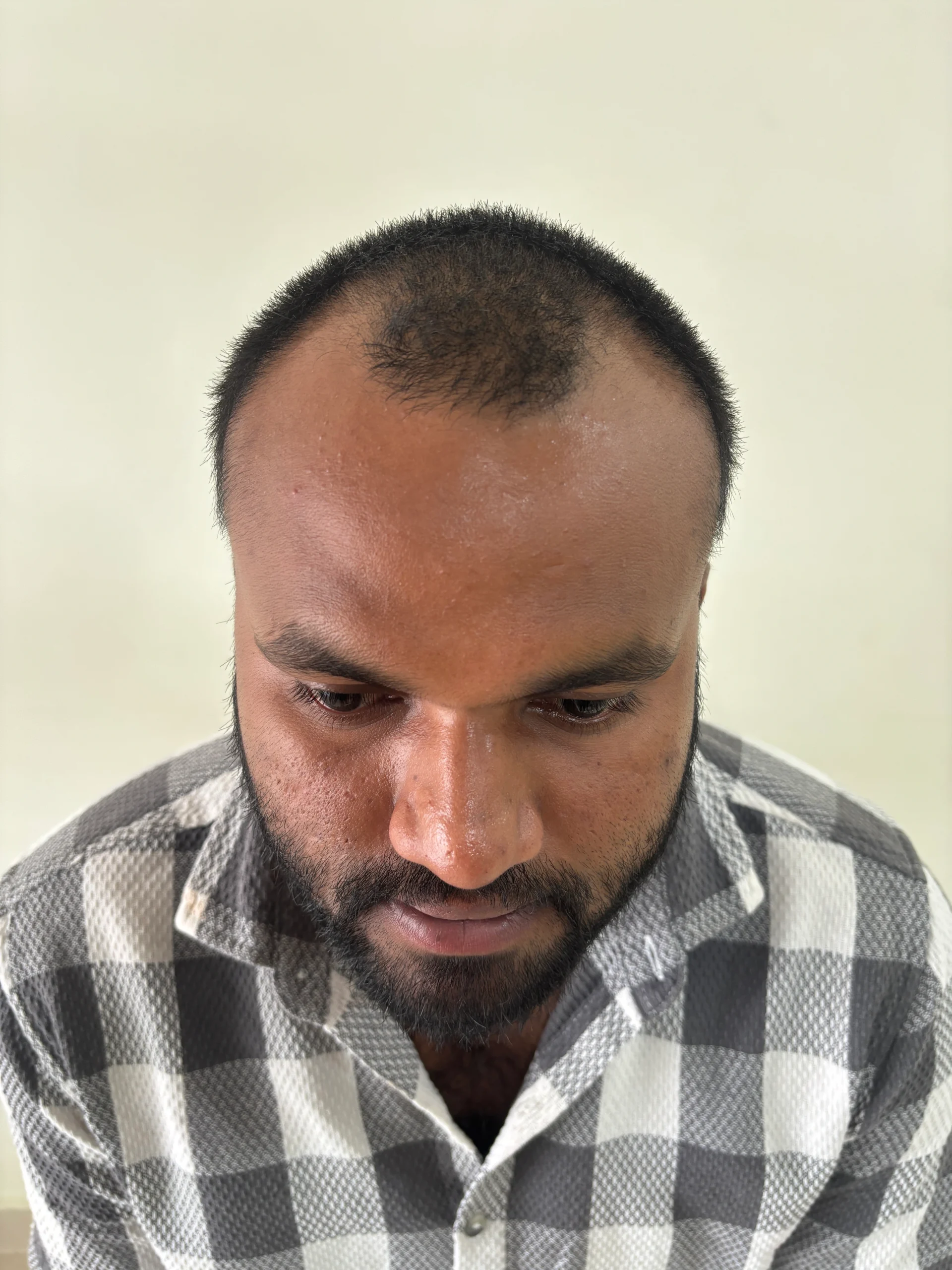 Home 16 IMG 4775 scaled Rewind Aesthetics